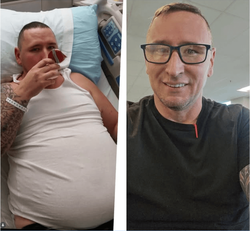 Life-changing weight loss transformation